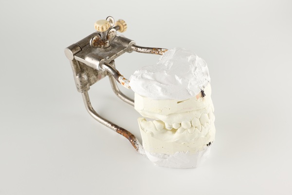 How Bone Grafts Enhance Periodontal Wellness